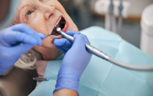dental work on mouth